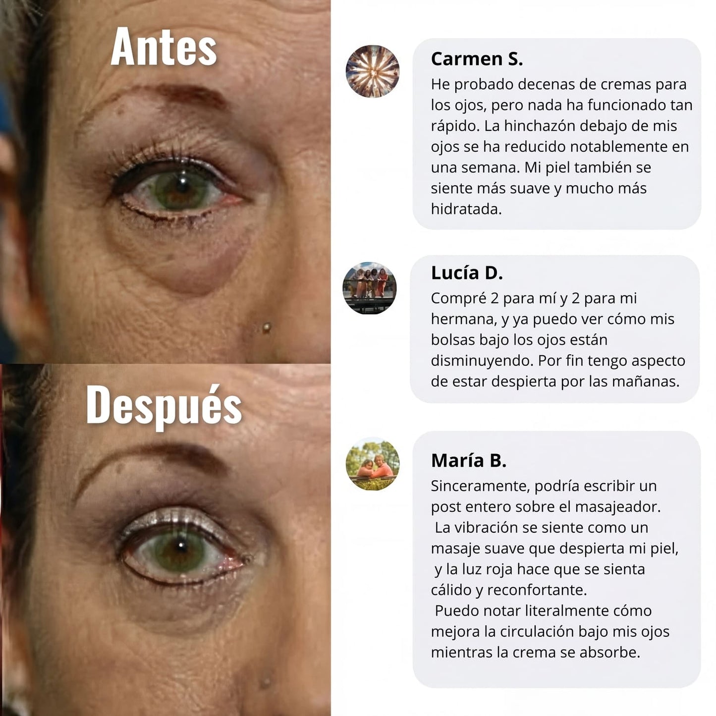 LumiEyes™ – Crema de Luz Roja para Ojos