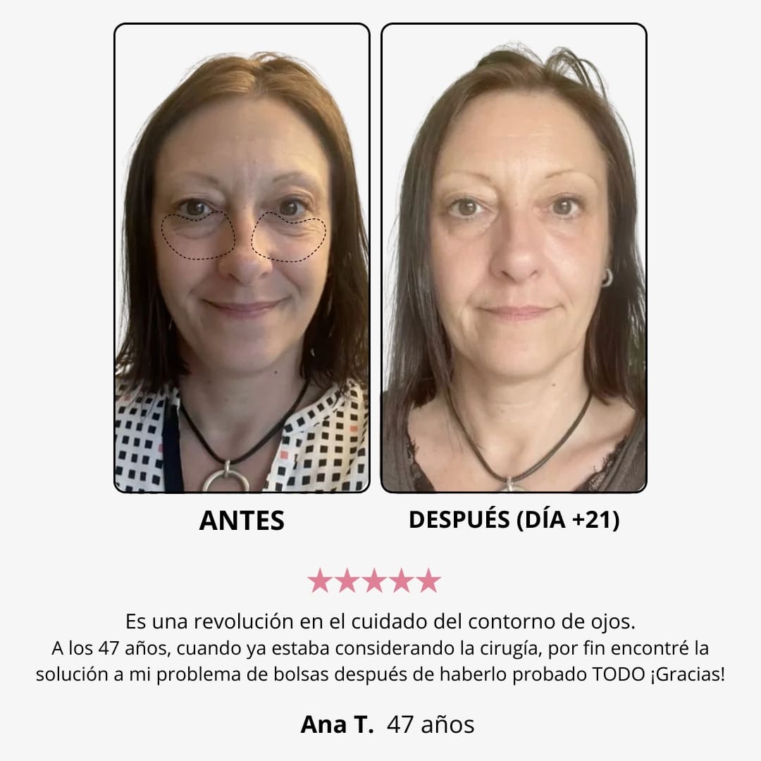 LumiEyes™ – Crema de Luz Roja para Ojos