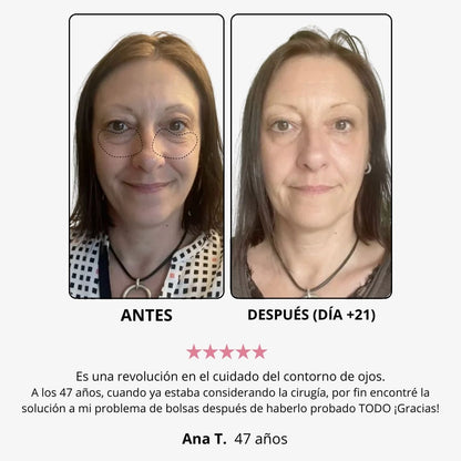 LumiEyes™ – Crema de Luz Roja para Ojos