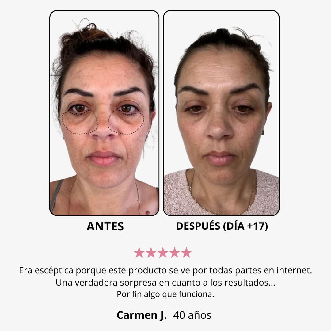 LumiEyes™ – Crema de Luz Roja para Ojos
