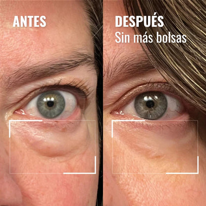 LumiEyes™ – Crema de Luz Roja para Ojos